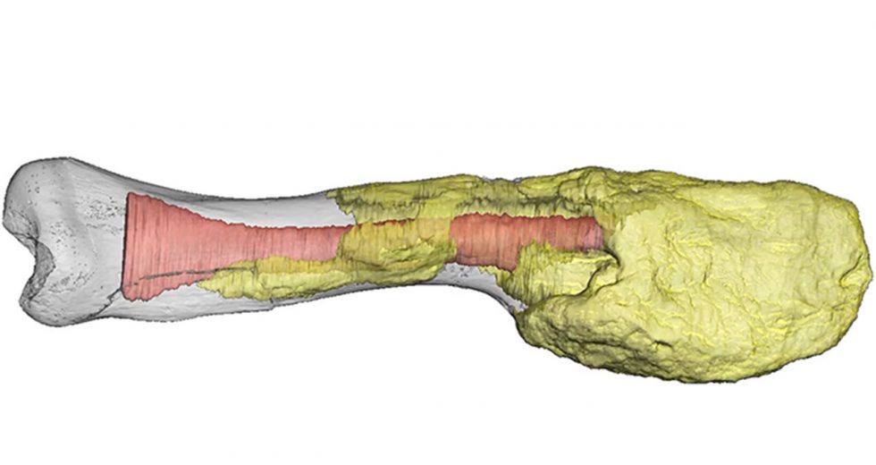 Câncer é encontrado em fóssil de osso de dinossauro